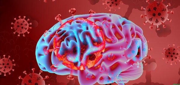 ماندگاری نشانه‌های کرونا تا 8 ماه پس از ابتلا